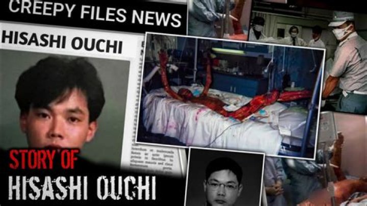 Is the Hisashi Ouchi Photo Real? Unraveling a Tragic Story