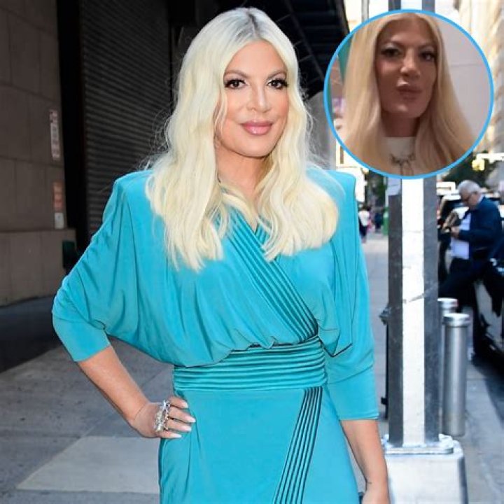Tori Spelling Accused of Getting Face Fillers Amid ​Money Woes